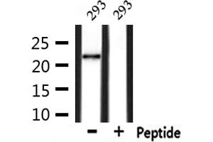 Western blot analysis of extracts from 293, using GPX4 Antibody. (GPX4 antibody  (C-Term))
