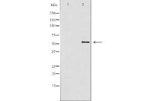 Western blot analysis of extracts from HuvEc cells, using GBA3 antibody. (GBA3 antibody  (Internal Region))
