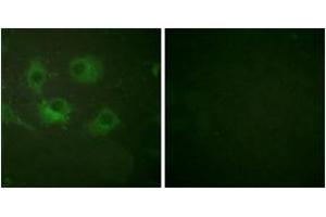 Immunofluorescence analysis of HuvEc cells, using Claudin 3 Antibody. (Claudin 3 antibody  (AA 171-220))