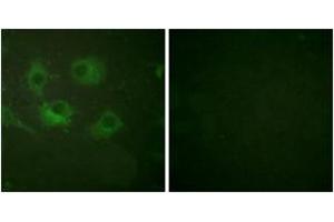 Immunofluorescence analysis of HuvEc cells, using Claudin 3 Antibody. (Claudin 3 antibody  (AA 171-220))