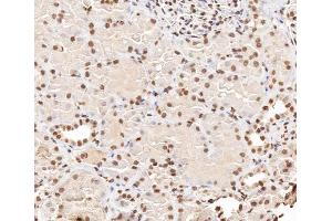 ABIN6267406 at 1/200 staining human kidney tissue sections by IHC-P. (Stathmin 1 antibody  (pSer38))