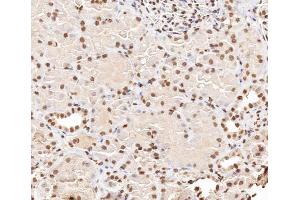 ABIN6267406 at 1/200 staining human kidney tissue sections by IHC-P.
