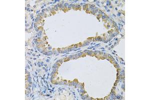 Immunohistochemistry of paraffin-embedded mouse lung using AP2B1 Antibody (ABIN1871002) at dilution of 1:100 (40x lens). (AP2B1 antibody)