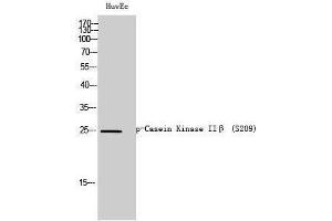 Western Blotting (WB) image for anti-Casein Kinase 2, beta (CSNK2B) (pSer209) antibody (ABIN3173273) (CSNK2B antibody  (pSer209))