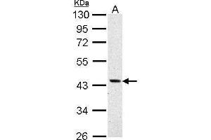 WB Image ASS1 antibody detects ASS1 protein by Western blot analysis.