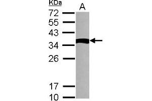 Western Blotting (WB) image for anti-NME Gene Family Member 9 (NME9) (AA 1-142) antibody (ABIN1501588) (NME9 antibody  (AA 1-142))