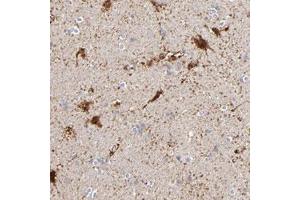 Immunohistochemical staining of human hippocampus with AURKA polyclonal antibody  shows strong cytoplasmic and nuclear positivity in neuronal cells. (Aurora A antibody)