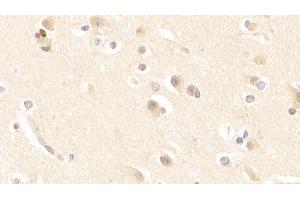 Detection of GLS in Human Cerebrum Tissue using Polyclonal Antibody to Glutaminase (GLS) (Glutaminase antibody  (AA 221-533))