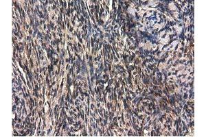 Immunohistochemical staining of paraffin-embedded Human liver tissue using anti-QPRT mouse monoclonal antibody.