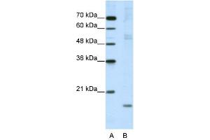 WB Suggested Anti-NIP7 Antibody Titration:  5.