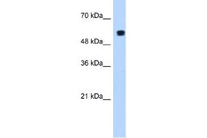 WB Suggested Anti-PUF60 Antibody  Titration: 1. (PUF60 antibody  (C-Term))