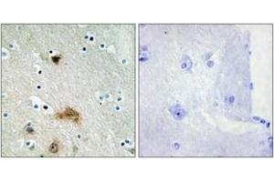 Immunohistochemistry analysis of paraffin-embedded human brain tissue, using LASS4 Antibody. (LASS4 antibody  (AA 41-90))