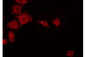 ABIN6275660 staining Hela by IF/ICC. (UBFD1 antibody  (Internal Region))