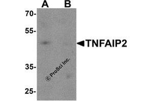 Western Blotting (WB) image for anti-Tumor Necrosis Factor, alpha-Induced Protein 2 (TNFAIP2) antibody (ABIN1077380) (TNFAIP2 antibody)