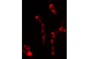 ABIN6267456 staining 293 cells by IF/ICC. (SHC1 antibody  (pTyr349))