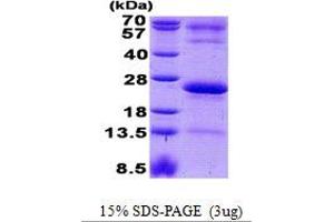 Image no. 1 for Immunoglobulin J Polypeptide, Linker Protein For Immunoglobulin alpha and mu Polypeptides (IGJ) protein (His tag) (ABIN1098584)