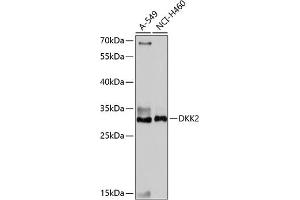 Western blot analysis of extracts of various cell lines, using DKK2 antibody (ABIN7266756) at 1:1000 dilution. (DKK2 antibody  (C-Term))