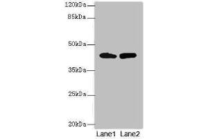 Western blot All lanes: NMUR1 antibody at 2 μg/mL Lane 1: Mouse liver tissue Lane 2: Mouse kidney tissue Secondary Goat polyclonal to rabbit IgG at 1/10000 dilution Predicted band size: 47 kDa Observed band size: 47 kDa (NMUR1 antibody  (AA 360-426))