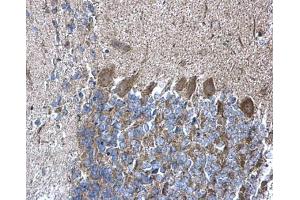 IHC-P Image RPL5 antibody detects RPL5 protein at cytoplasm on mouse hind brain by immunohistochemical analysis.