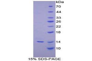 SDS-PAGE (SDS) image for Inhibin, beta C (INHBC) (AA 236-352) protein (His tag) (ABIN1079939) (INHBC Protein (AA 236-352) (His tag))