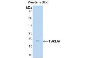 Western Blotting (WB) image for anti-Gonadotropin-Releasing Hormone 1 (Luteinizing-Releasing Hormone) (GNRH1) (AA 22-140) antibody (FITC) (ABIN1859037) (GNRH1 antibody  (AA 22-140) (FITC))