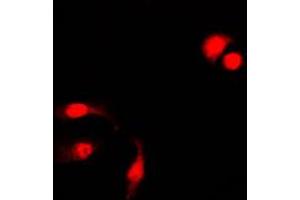 Immunofluorescent analysis of NF-kappaB p105 (pS927) staining in HeLa cells.