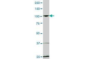 EVI5L MaxPab polyclonal antibody. (EVI5L antibody  (AA 1-794))