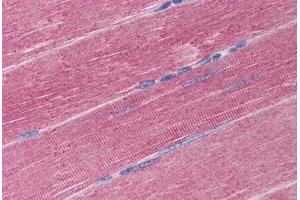Human Skeletal Muscle (formalin-fixed, paraffin-embedded) stained with ADAM17 antibody ABIN290260 at 20 ug/ml followed by biotinylated goat anti-rabbit IgG secondary antibody ABIN481713, alkaline phosphatase-streptavidin and chromogen. (ADAM17 antibody  (C-Term))