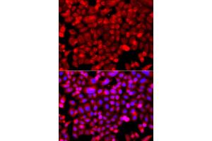 Immunofluorescence analysis of A549 cells using NDUFV1 antibody (ABIN5974962).