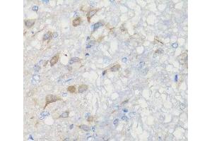 Immunohistochemistry of paraffin-embedded Rat brain using CHIC2 Polyclonal Antibody at dilution of 1:100 (40x lens).