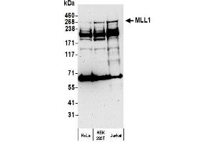 anti-Myeloid/lymphoid Or Mixed-Lineage Leukemia 1 (MLL1) (AA 720-780) antibody