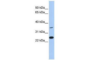 WB Suggested Anti-LYVE1 Antibody Titration: 0. (LYVE1 antibody  (N-Term))