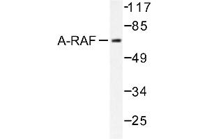 Image no. 1 for anti-V-Raf Murine Sarcoma 3611 Viral Oncogene Homolog (ARAF) antibody (ABIN271994) (ARAF antibody)