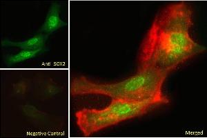 ABIN6391384 Immunofluorescence analysis of paraformaldehyde fixed U251 cells, permeabilized with 0. (SOX2 antibody  (N-Term))