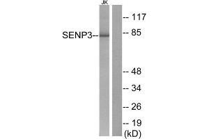 Western Blotting (WB) image for anti-SUMO/sentrin Specific Peptidase 3 (SENP3) (N-Term) antibody (ABIN1848843) (SENP3 antibody  (N-Term))
