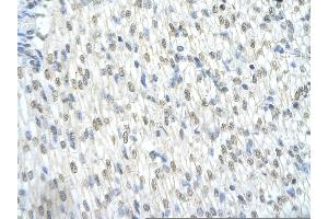 Rabbit Anti-CTNNB1 Antibody     AV  Paraffin Embedded Tissue:  Human cardiac cell   Cellular Data:  Epithelial cells of renal tubule  Antibody Concentration:   4. (CTNNB1 antibody  (C-Term))