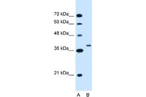 WB Suggested Anti-RNF146 Antibody Titration:  1. (RNF146 antibody  (C-Term))