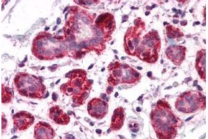 Human Breast: Formalin-Fixed, Paraffin-Embedded (FFPE) (SH3BP4 antibody  (C-Term))