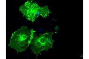 Image no. 4 for anti-Fc gamma RII (CD32) antibody (ABIN1497254) (Fc gamma RII (CD32) antibody)