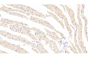 Detection of SOD3 in Mouse Cardiac Muscle Tissue using Polyclonal Antibody to Superoxide Dismutase 3, Extracellular (SOD3) (SOD3 antibody  (AA 25-251))