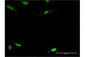 Immunofluorescence of monoclonal antibody to PBK on HeLa cell. (PBK antibody  (AA 122-229))