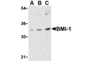 Image no. 1 for anti-BMI1 Polycomb Ring Finger Oncogene (BMI1) (Middle Region) antibody (ABIN318769) (BMI1 antibody  (Middle Region))