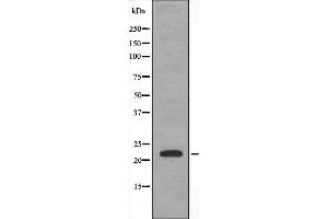 Western blot analysis of extracts from HeLa using CRP1 antibody. (CSRP1 antibody  (Internal Region))
