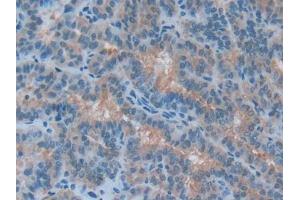Used in DAB staining on fromalin fixed paraffin- embedded liver tissue (Acetylcholinesterase antibody  (AA 366-554))