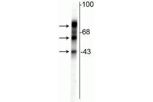 Western blot of rat cortical lysate showing specific immunolabeling of the ~48 kDa, ~65 kDa & ~75 kDa tau isoforms. (MAPT antibody)