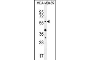 AKT1 (Thr308) Antibody (ABIN654500 and ABIN2844231) western blot analysis in MDA-M cell line lysates (35 μg/lane). (AKT1 antibody  (Thr308))