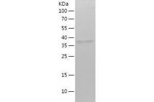 Western Blotting (WB) image for Keratin 15 (KRT15) (AA 350-456) protein (His-IF2DI Tag) (ABIN7123673) (KRT15 Protein (AA 350-456) (His-IF2DI Tag))
