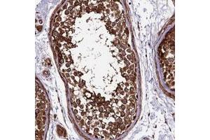 Immunohistochemical staining of human testis with LSM7 polyclonal antibody  shows strong cytoplasmic positivity in cells in seminiferus duct. (LSM7 antibody)
