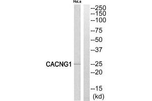 Western Blotting (WB) image for anti-Calcium Channel, Voltage-Dependent, gamma Subunit 1 (CACNG1) (Internal Region) antibody (ABIN1852387) (CACNG1 antibody  (Internal Region))