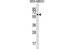 Western Blotting (WB) image for anti-Butyrophilin, Subfamily 3, Member A1 (BTN3A1) antibody (ABIN2997361) (BTN3A1 antibody)